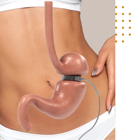 chirurgie poches sous les yeux en Tunisie