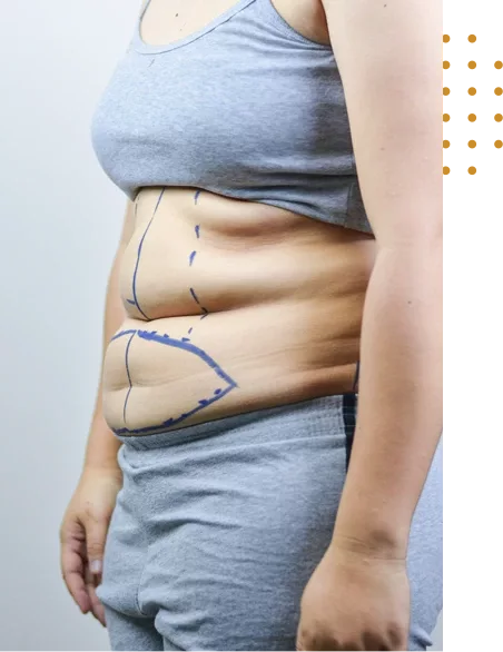 chirurgie poches sous les yeux en Tunisie