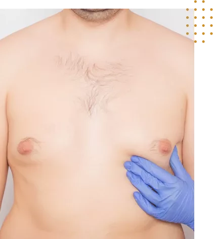 chirurgie paupieres Tunisie