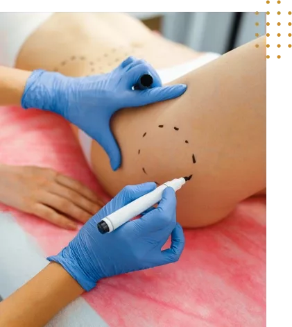 chirurgie paupieres Tunisie