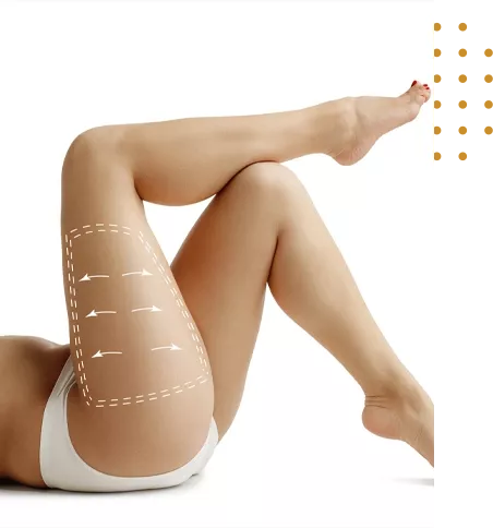 chirurgie poches sous les yeux en Tunisie