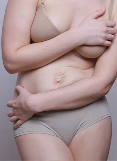 chirurgie paupieres Tunisie