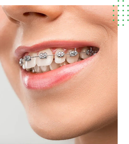 chirurgie paupieres Tunisie