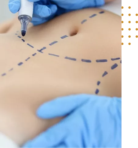 chirurgie paupieres Tunisie