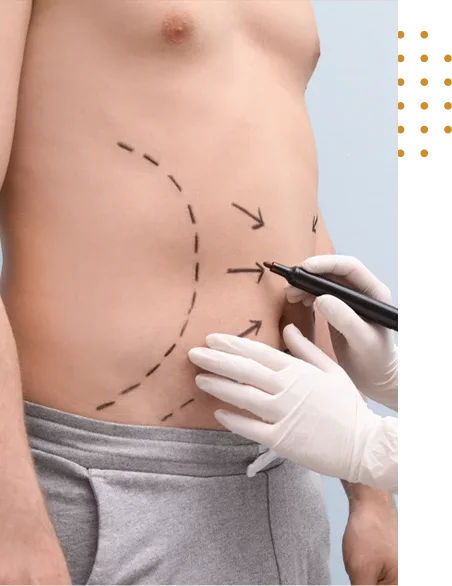 chirurgie poches sous les yeux en Tunisie